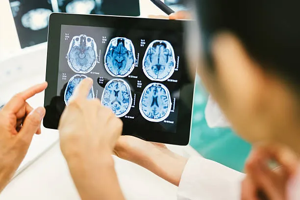 Brain injury claims