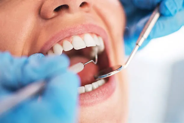 Dental negligence claims